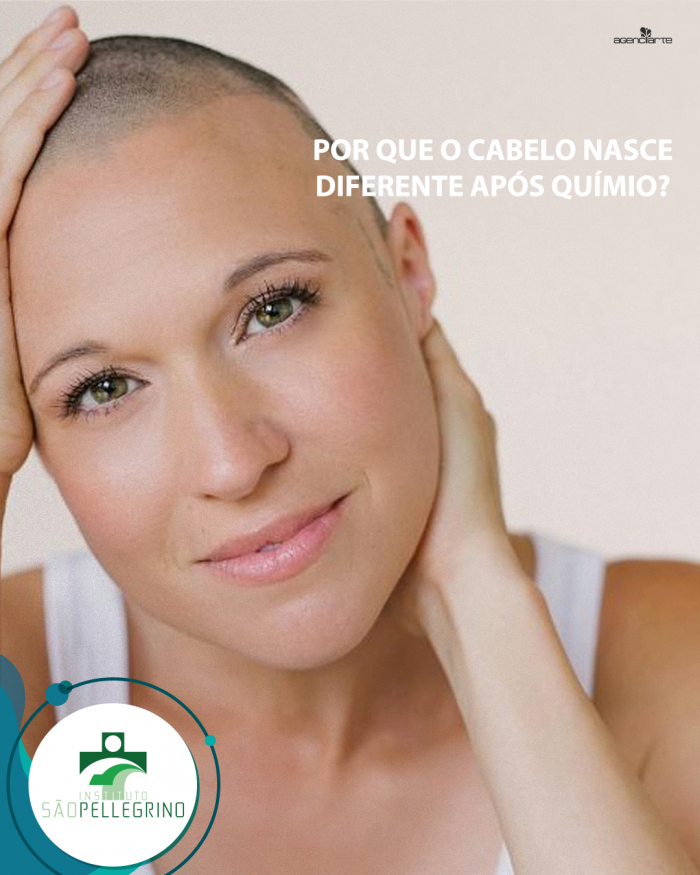 Por que o cabelo cresce diferente após químio?