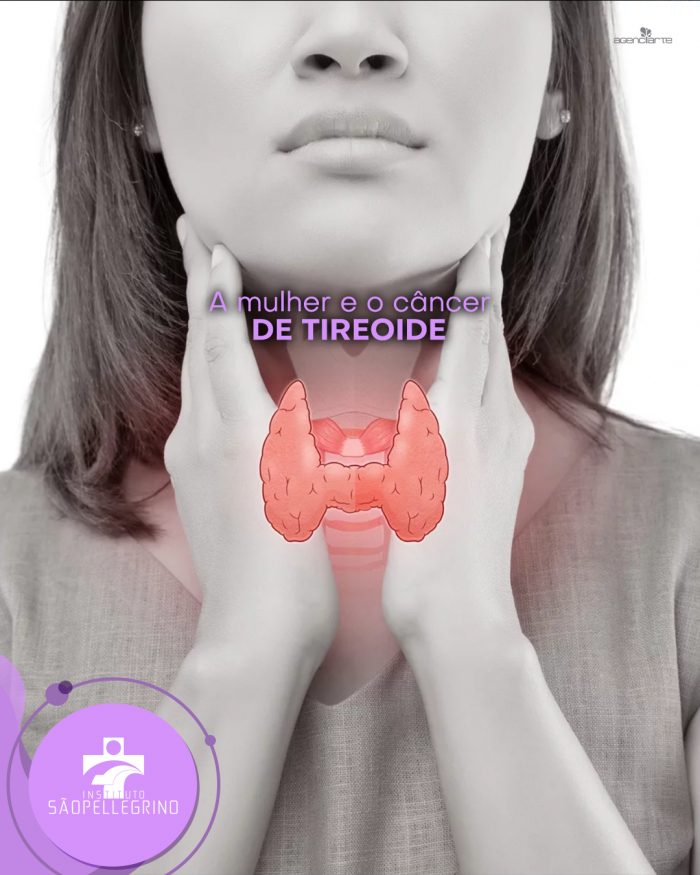 Mulher e o câncer de tireoide