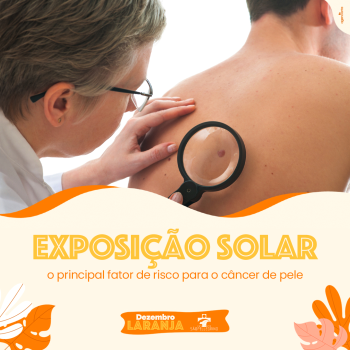 Conheça o Principal Fator de Risco para o Câncer de Pele.