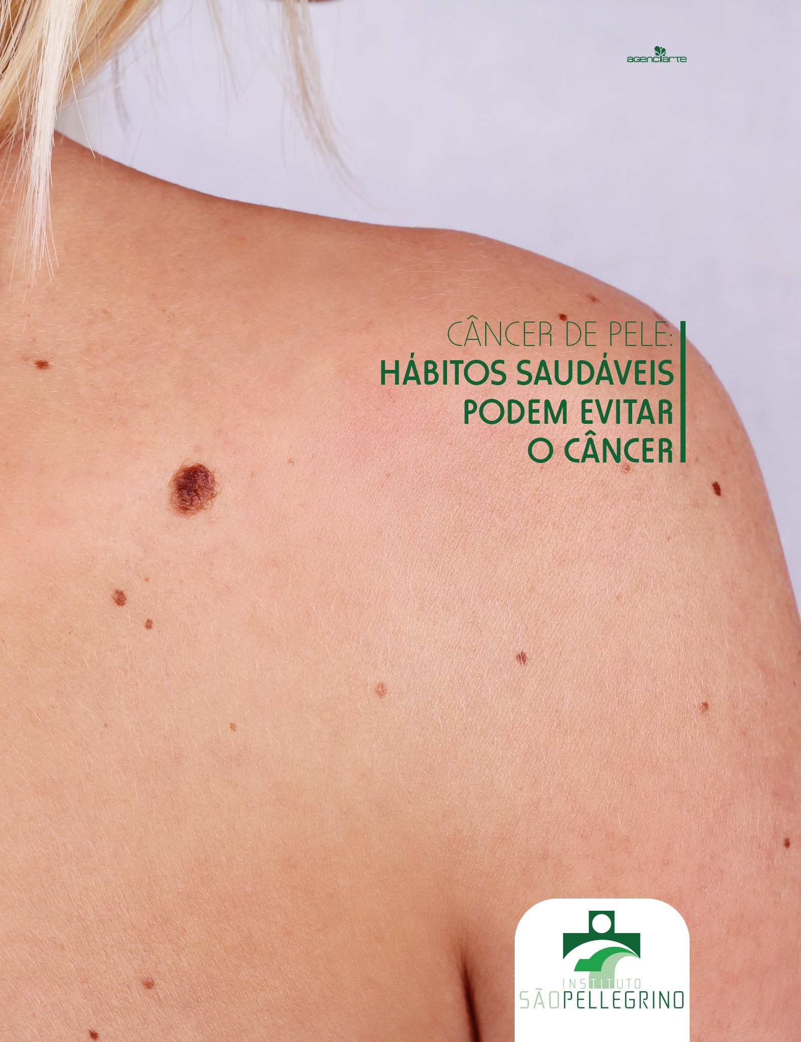 CÂNCER DE PELE