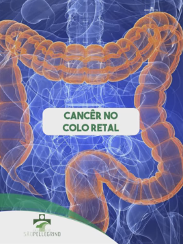 CÂNCER NO COLO RETAL