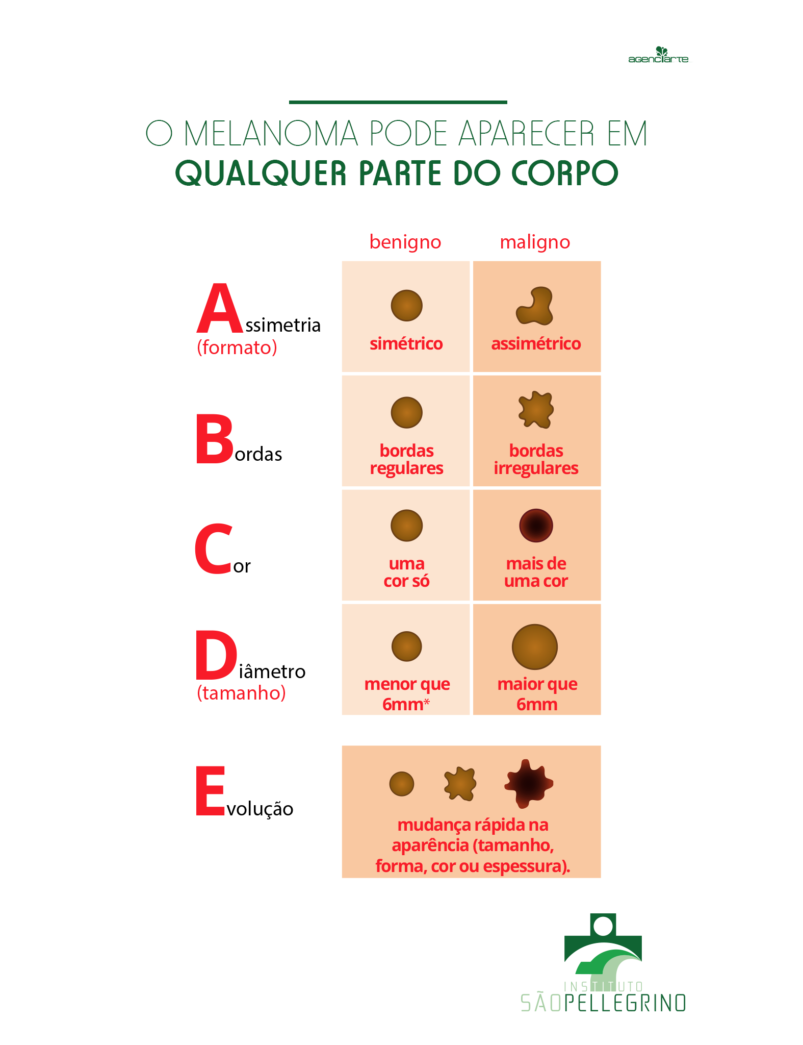 O MELANOMA PODE APARECER EM QUALQUER PARTE DO CORPO